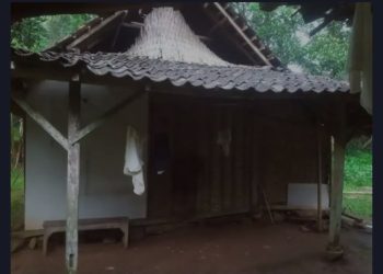 Derita Solekan yang Matanya Diserang Tumor Ganas, Siapa Mau Peduli ?