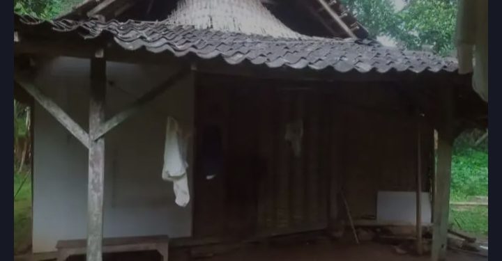 Derita Solekan yang Matanya Diserang Tumor Ganas, Siapa Mau Peduli ?