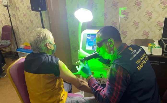 Salah satu peserta mengikuti program hapus tato di RSUD Kebayoran Lama, Jakarta, Kamis (14/8/2025). (Jakartaterkini)